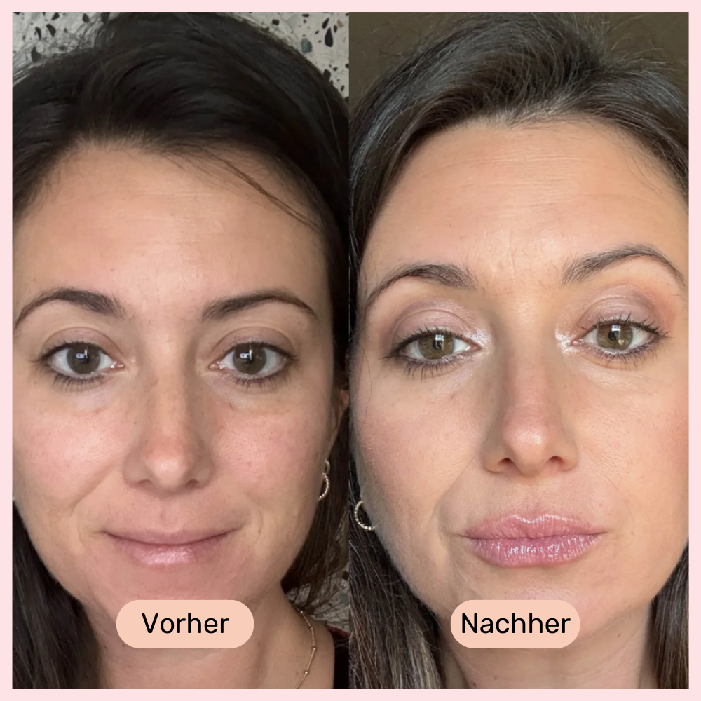LipBooster, Natürliche Vollere Lippen